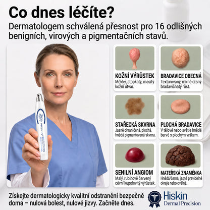 Oficiální značkový obchod | 🎄🎄Hiskin® 7denní odstraňovač skvrn a pigmentových skvrn (Bezbolestný rollerball bez jizev)
