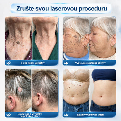 Oficiální značkový obchod | 🎄🎄Hiskin® 7denní odstraňovač skvrn a pigmentových skvrn (Bezbolestný rollerball bez jizev)