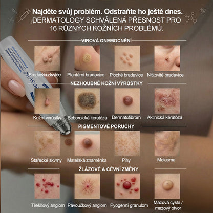 Oficiální značkový obchod | 🎄🎄Hiskin® 7denní odstraňovač skvrn a pigmentových skvrn (Bezbolestný rollerball bez jizev)